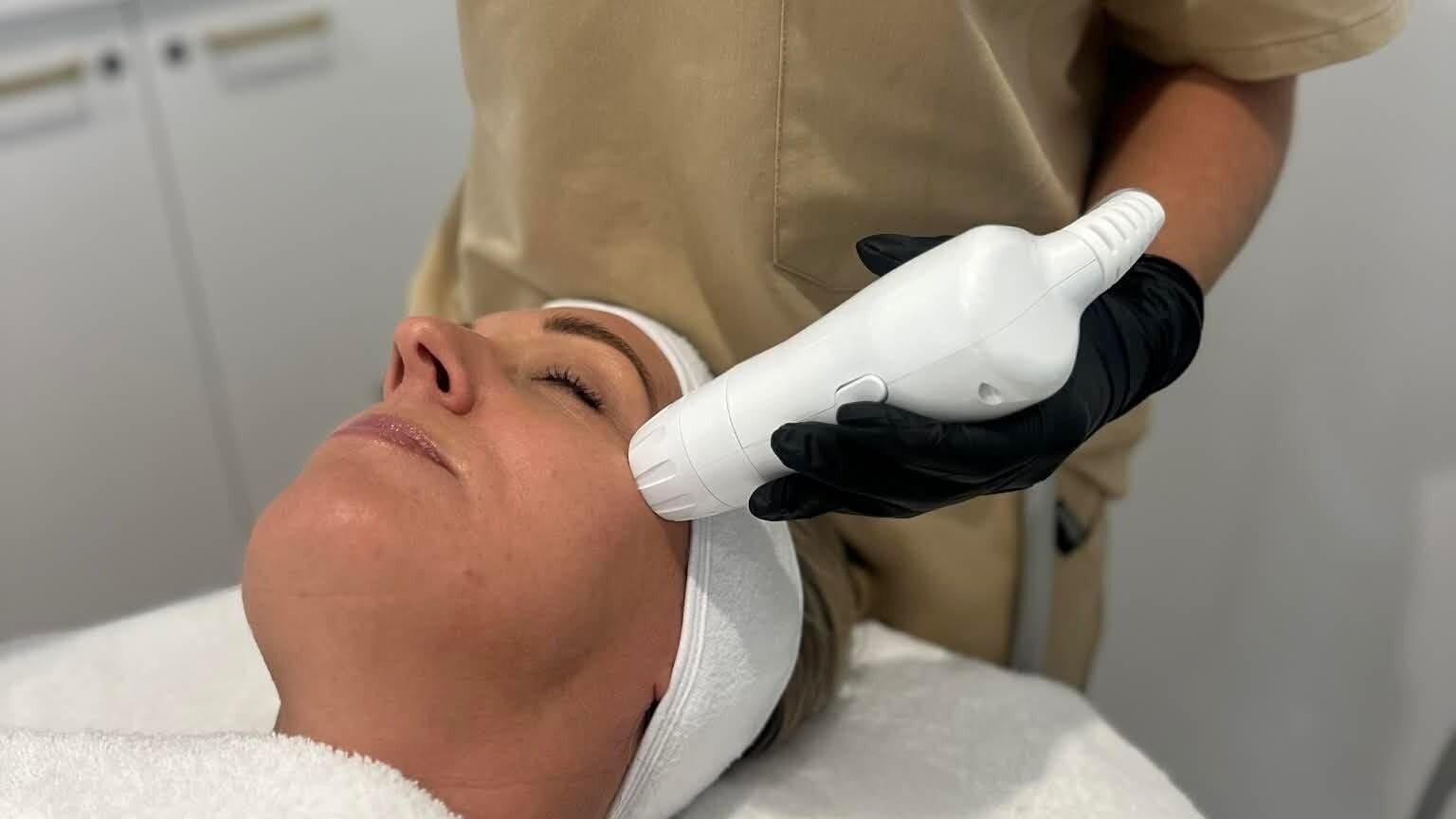 Bio microneedling treatment at e-skin